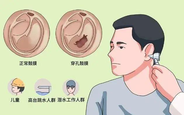 鼻窦炎的急性发作期,因为此其可以导致咽鼓管的开闭不全,发生呛水后